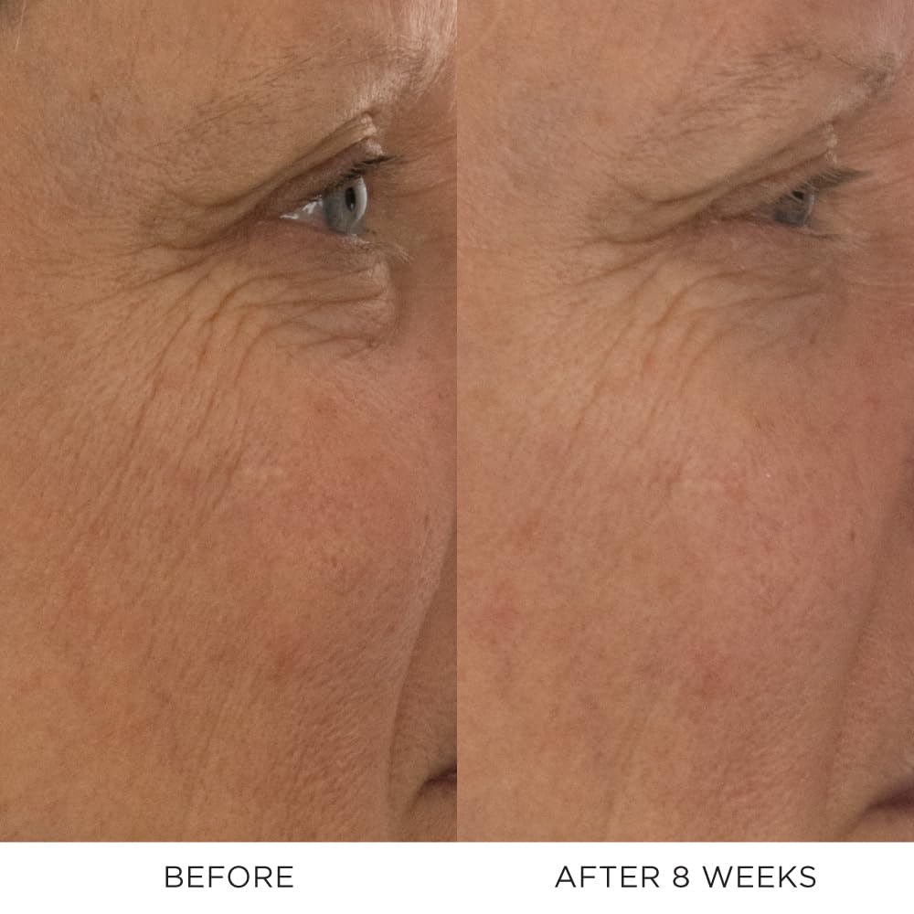 Absolute Restoring Eye Cream DOSE