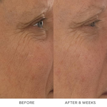 Absolute Restoring Eye Cream DOSE
