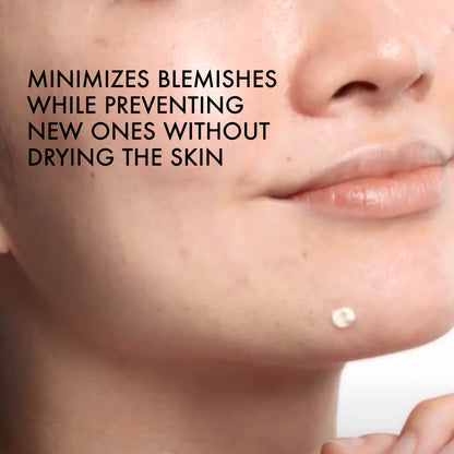 Vichy Normaderm S.O.S Acne Rescue Spot Corrector, Acne Spot Treatment for Face with 10% Sulfur, Niacinamide & Glycolic Acid, Suitable for Sensitive Skin