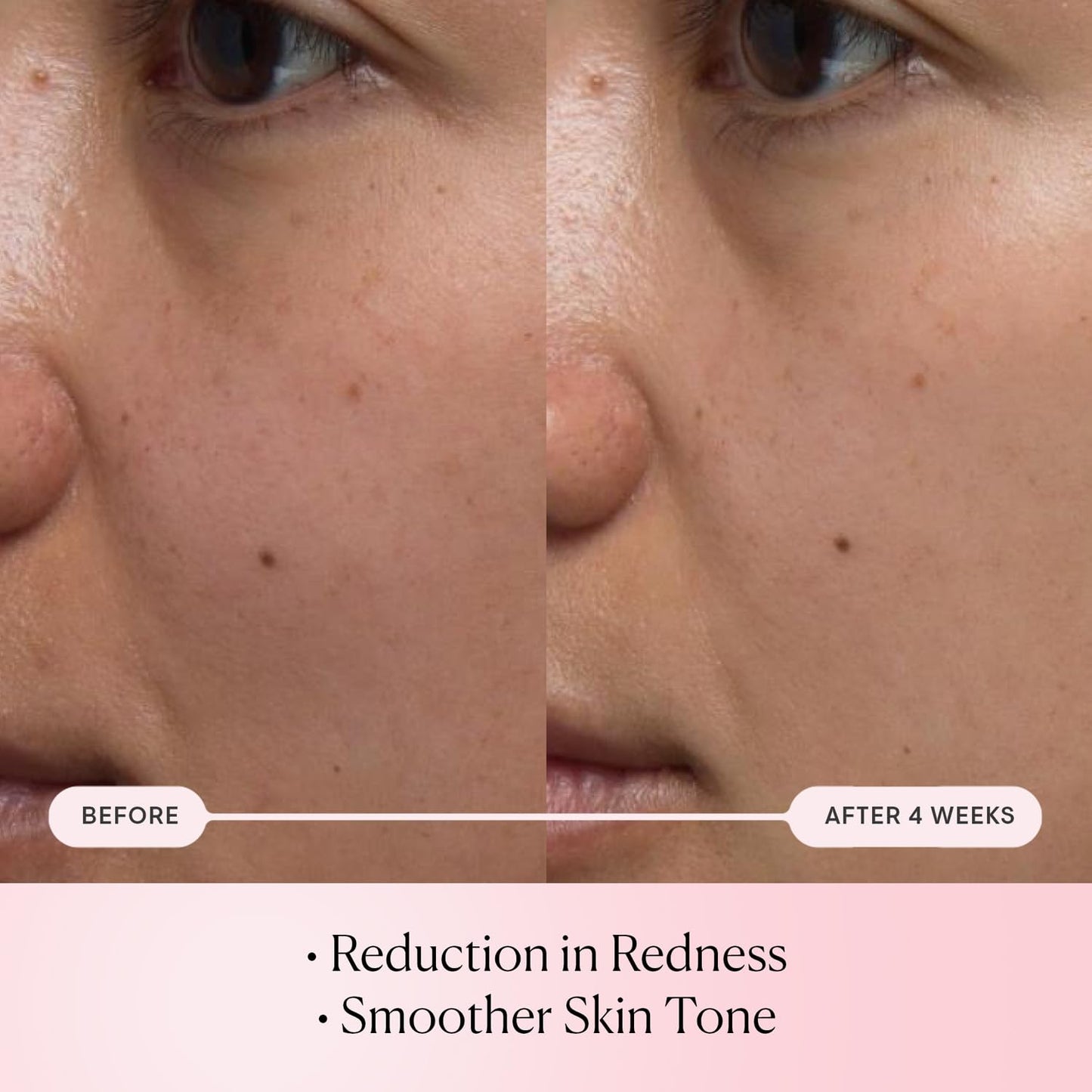 ELEMIS Pro-Collagen Rose Micro Serum | Hydration serum that plumps, soothes, and nourishes your skin while reducing fine lines & wrinkles.