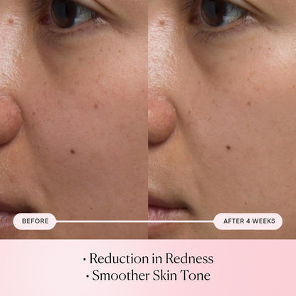 ELEMIS Pro-Collagen Rose Micro Serum | Hydration serum that plumps, soothes, and nourishes your skin while reducing fine lines & wrinkles.