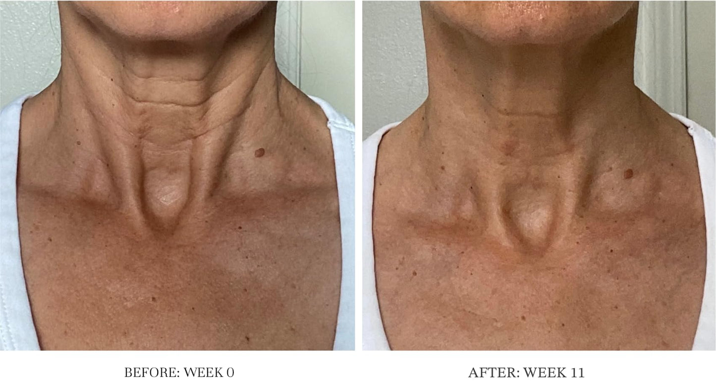 City Beauty Ultra-Firming Dry Oil - Neck & Décolletage Treatment - Hydrate & Lift - Solution for Crepey Skin, Sagging, & Wrinkles - Non-Greasy Formula - Anti-Aging Cruelty-Free Skin Care