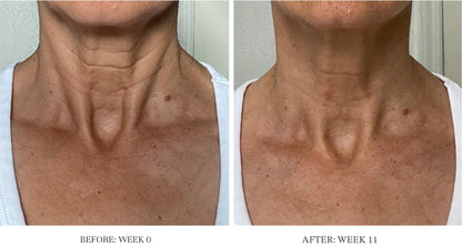 City Beauty Ultra-Firming Dry Oil - Neck & Décolletage Treatment - Hydrate & Lift - Solution for Crepey Skin, Sagging, & Wrinkles - Non-Greasy Formula - Anti-Aging Cruelty-Free Skin Care