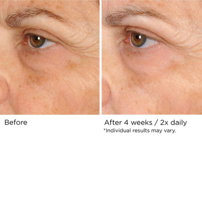 NASSIFMD Peri-Orbital Under Eye Cream for Wrinkles, Under Eye Cream Dark Circles and Puffiness, Under Eye Dark Circles Treatment, Eye Wrinkle Cream, Dark Eyes Circle Treatment