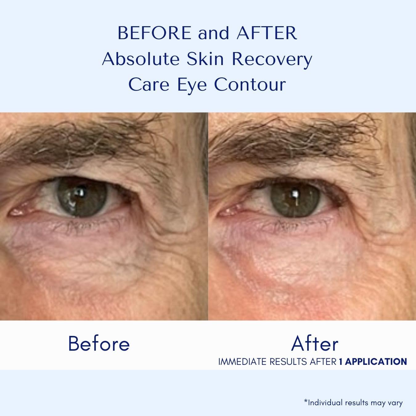 ORLANE PARIS Absolute Skin Recovery Care Eye Contour - Gel Cream Formula for Rested and Rejuvenated Eye Area - Helps to Improve Appearance of Puffiness and Dark Circles (15ml)