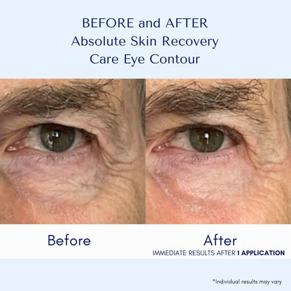 ORLANE PARIS Absolute Skin Recovery Care Eye Contour - Gel Cream Formula for Rested and Rejuvenated Eye Area - Helps to Improve Appearance of Puffiness and Dark Circles (15ml)