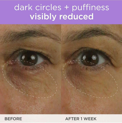 TATCHA The Brightening Eye Cream | Brightening & Dark Circle Reduction with Vitamin C for Bight, Firm Undereyes, 15 ml / 0.5 fl. oz.