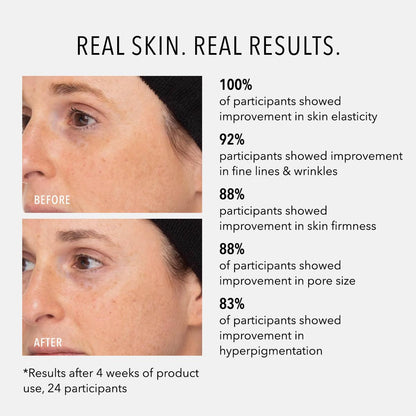 HydroPeptide Retinol Routine Booster, 1% Universal Tri-Retinol Complex Peptide Solution, 1 Ounce