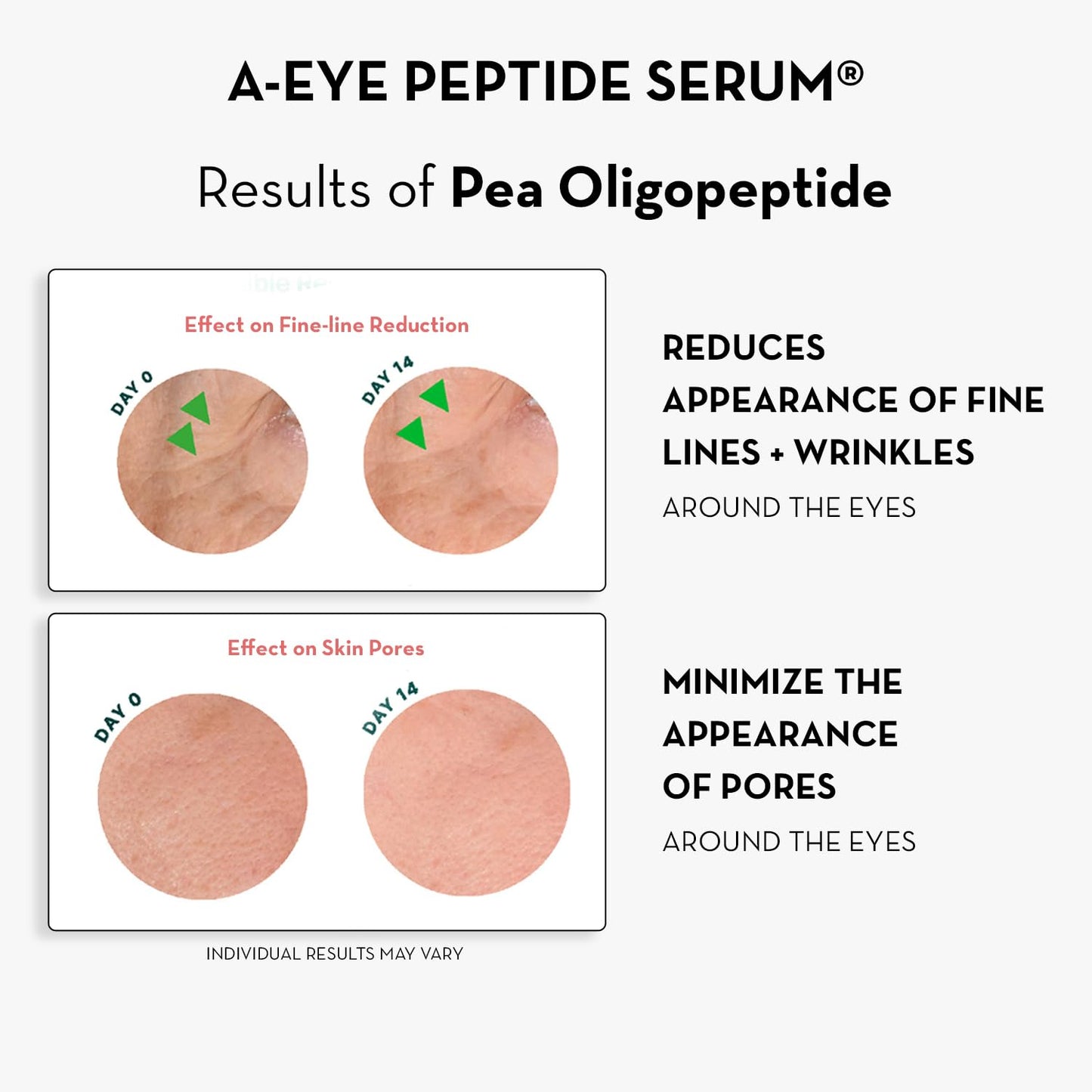 Sonage A-Eye Peptide Serum: for Dark Circles, Puffiness, Under Eye Bags, Wrinkles & Fine Lines | Anti-aging Serum for Eyes