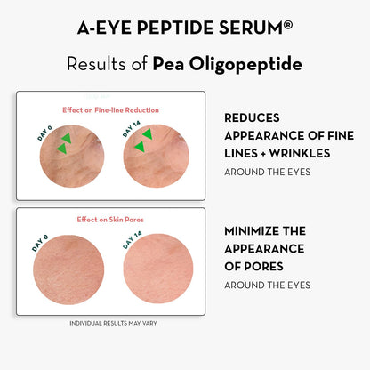 Sonage A-Eye Peptide Serum: for Dark Circles, Puffiness, Under Eye Bags, Wrinkles & Fine Lines | Anti-aging Serum for Eyes