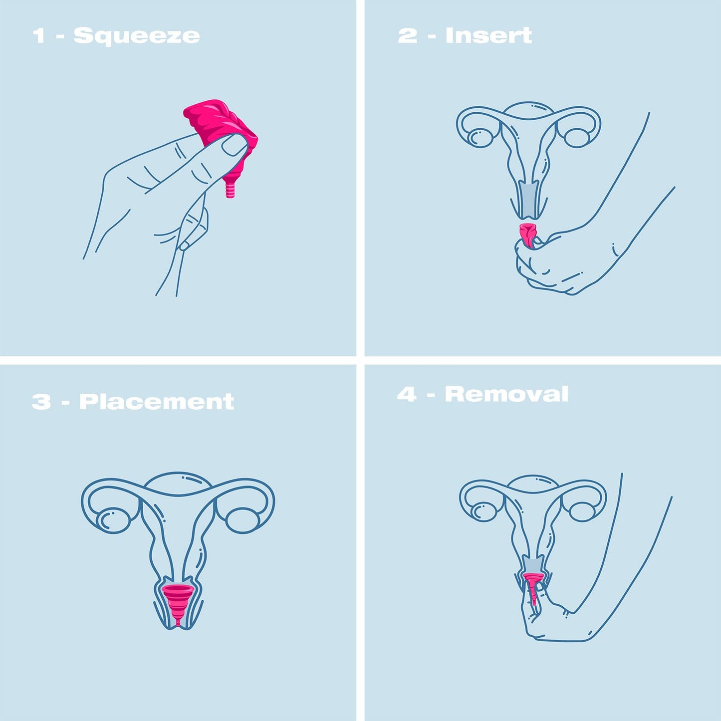 Intimina Lily Cup Compact - Small Menstrual Cup with Flat-fold Compact Design, Disposable Menstrual Cups, Period Cup Reusable (A)