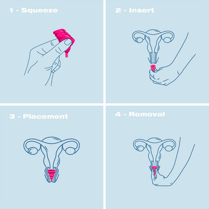 Intimina Lily Cup Compact - Small Menstrual Cup with Flat-fold Compact Design, Disposable Menstrual Cups, Period Cup Reusable (A)