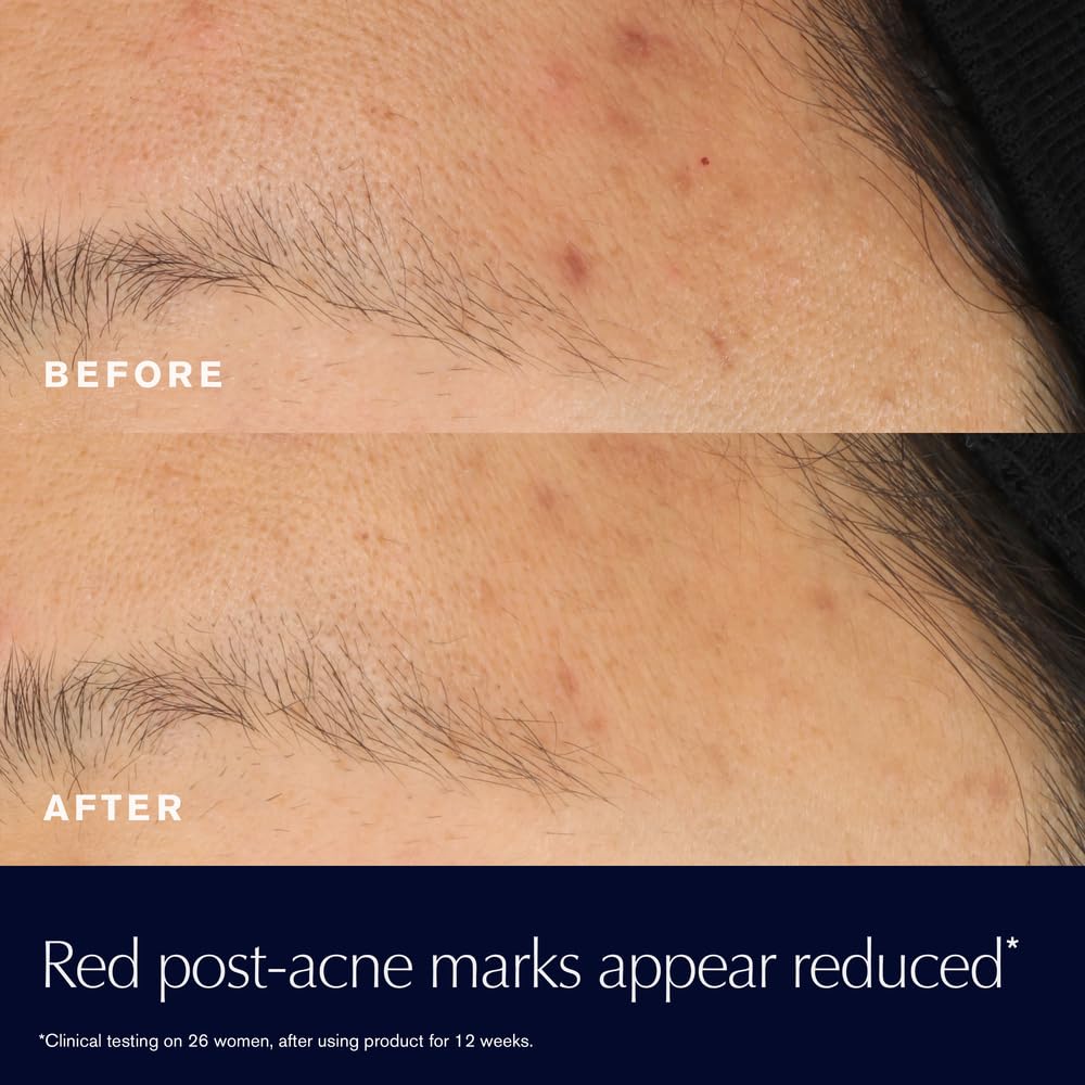 Estée Lauder Advanced Night Repair Rescue Solution with 15% Bifidus Ferment to Reduce Visible Redness, 0.68 Fl Oz