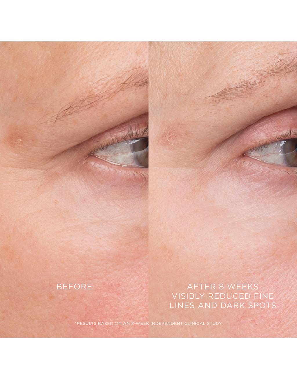 Hourglass Equilibrium Resurfacing Retinoid Treatment