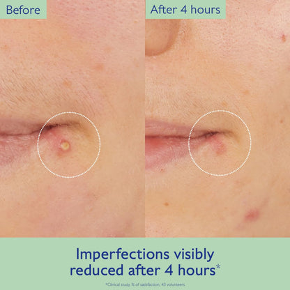 Caudalie Vinopure Targeted Spot Solution with Salicylic Acid - 15 mL