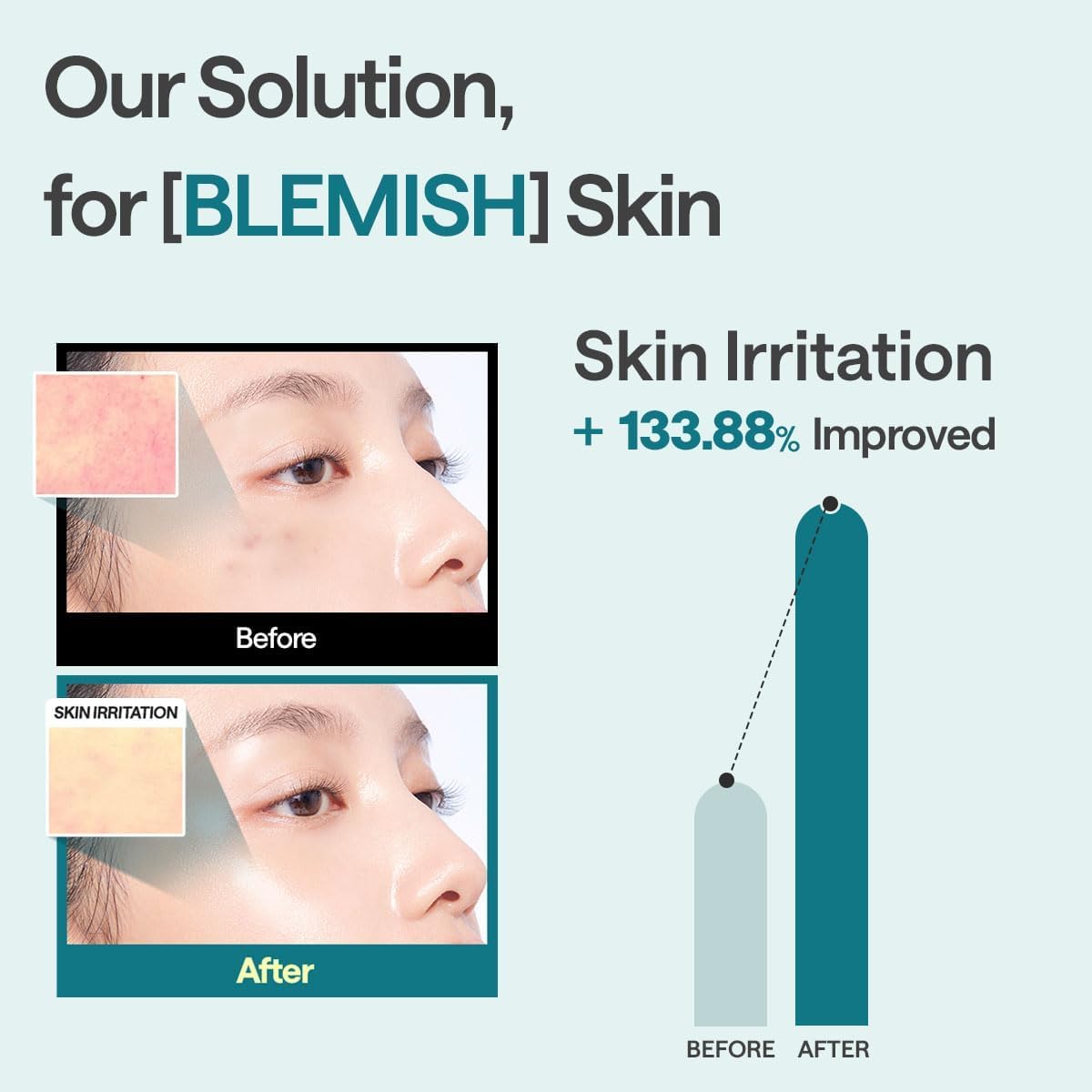 Mediheal Essential Face Mask Blemish Repair 10 pcs. with 98% Purity Madecassoside & Hyaluronic Acid - Soothing Care, Hydrating- Travel Essentials, Vegan Formula Korean Sheet Mask