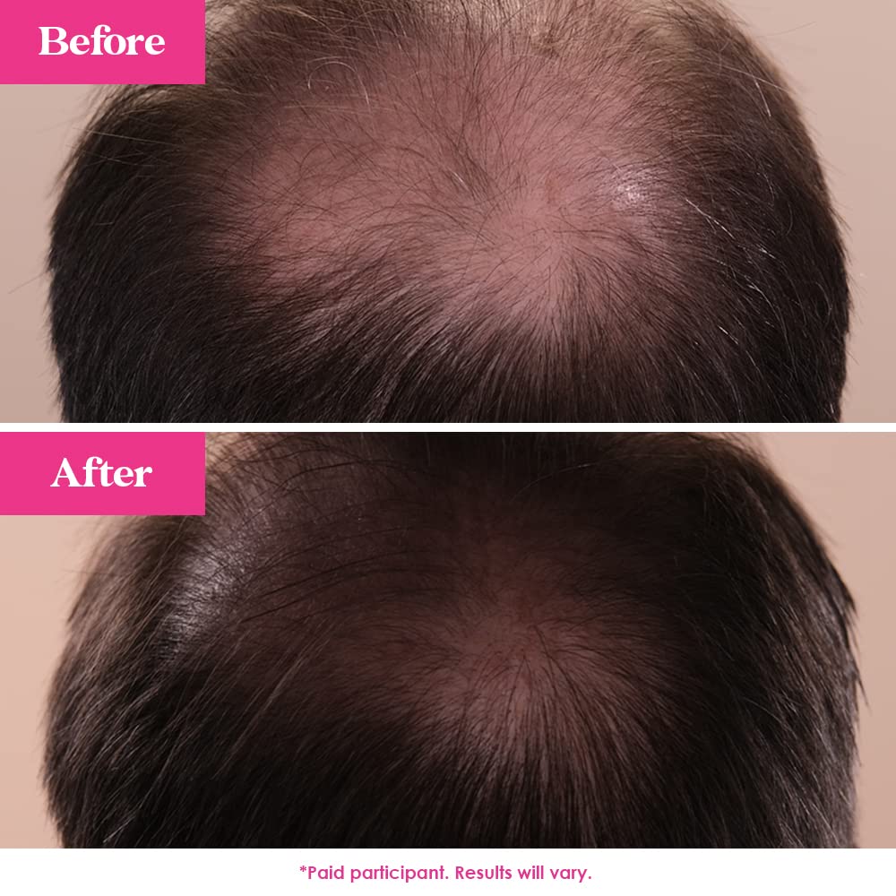 Grande Cosmetics GrandeHAIR Hair Enhancing Serum for Men and Women, Promotes Thickness in Thinning Hair, Safe for Color Treated Hair