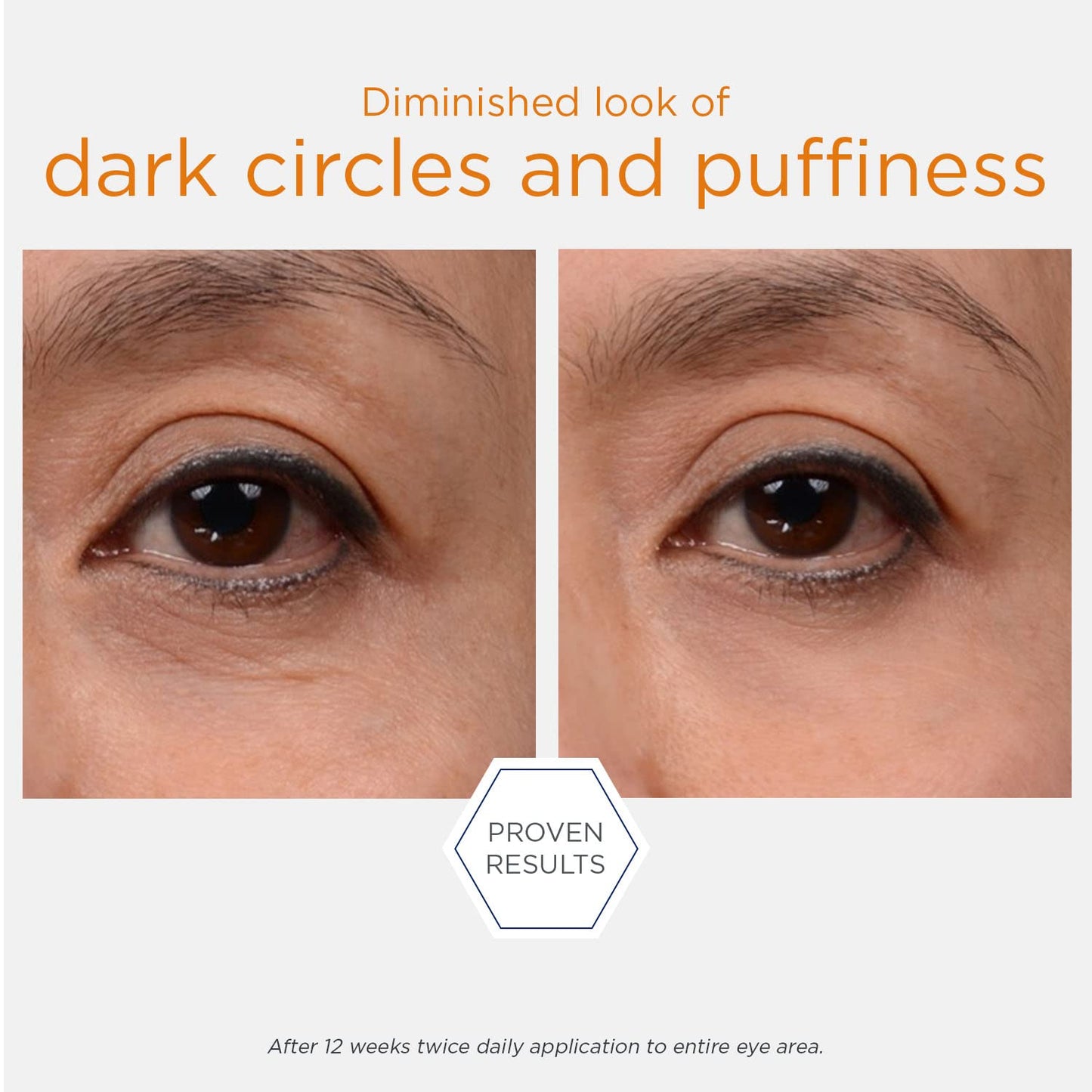 NEOSTRATA Brightening Eye Cream Dark Circle Corrector with Antioxidants, Peptides, and Algae Extract Fragrance-Free, 15 g.