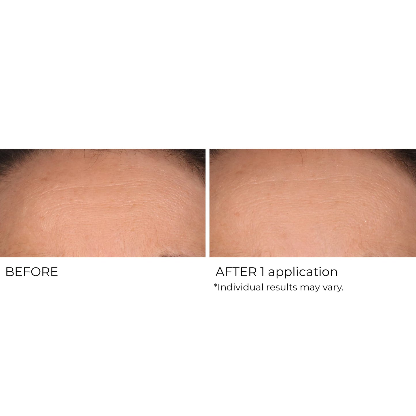 NassifMD Wrinkle Blur Targeted Treatment
