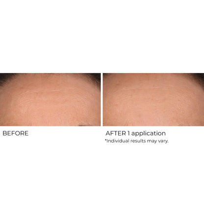 NassifMD Wrinkle Blur Targeted Treatment