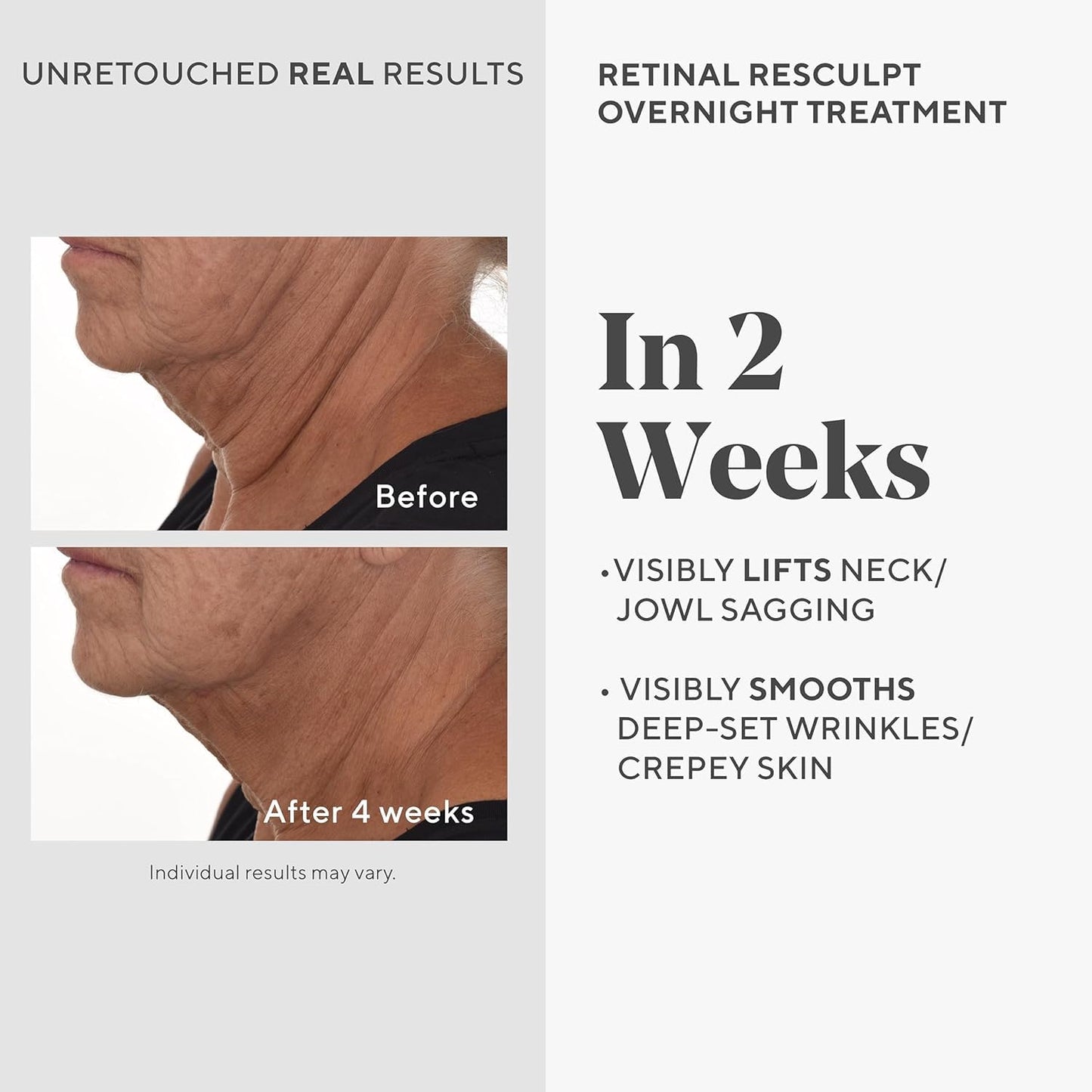 Murad Retinal ReSculptors – 2-Piece Full Size Kit ($197 Value) - Retinal Serum & Eye Cream - 2.5x Vitamin A, Lifts, Firms, Anti-Aging, Encapsulated Retinal, Reduces Wrinkles on Face, Eyes & Neck