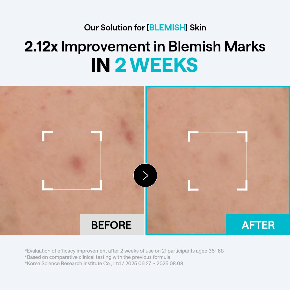 MEDIHEAL Madecassoside Blemish Pad - Square Cotton Facial Toner Pads with Centella Asiatica & Madecassoside – Anti Blemish to Improve Uneven Skin Tone - Vegan Face Gauze Pads, 100