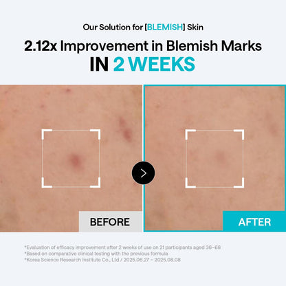 MEDIHEAL Madecassoside Blemish Pad - Square Cotton Facial Toner Pads with Centella Asiatica & Madecassoside – Anti Blemish to Improve Uneven Skin Tone - Vegan Face Gauze Pads, 100