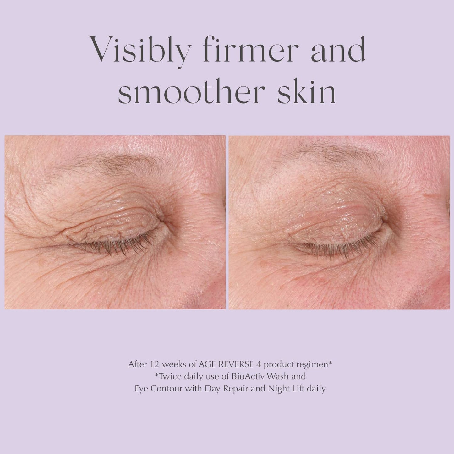 EXUVIANCE AGE REVERSE Day Repair SPF 30 Firming Face Cream with Retinol, NeoGlucosamine, Peptides and Antioxidant, 50 g.