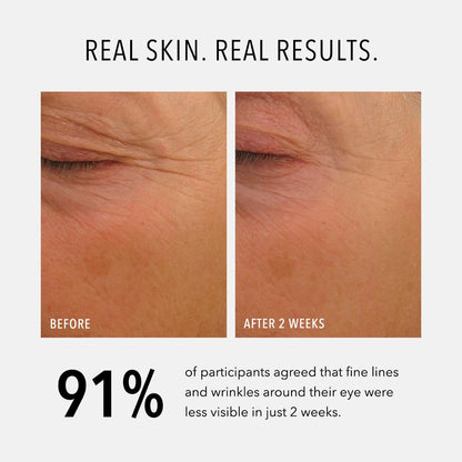 HydroPeptide Eye Authority, Brightens and Helps Restore Radiance to Tired Looking Eyes, 0.5 Ounce