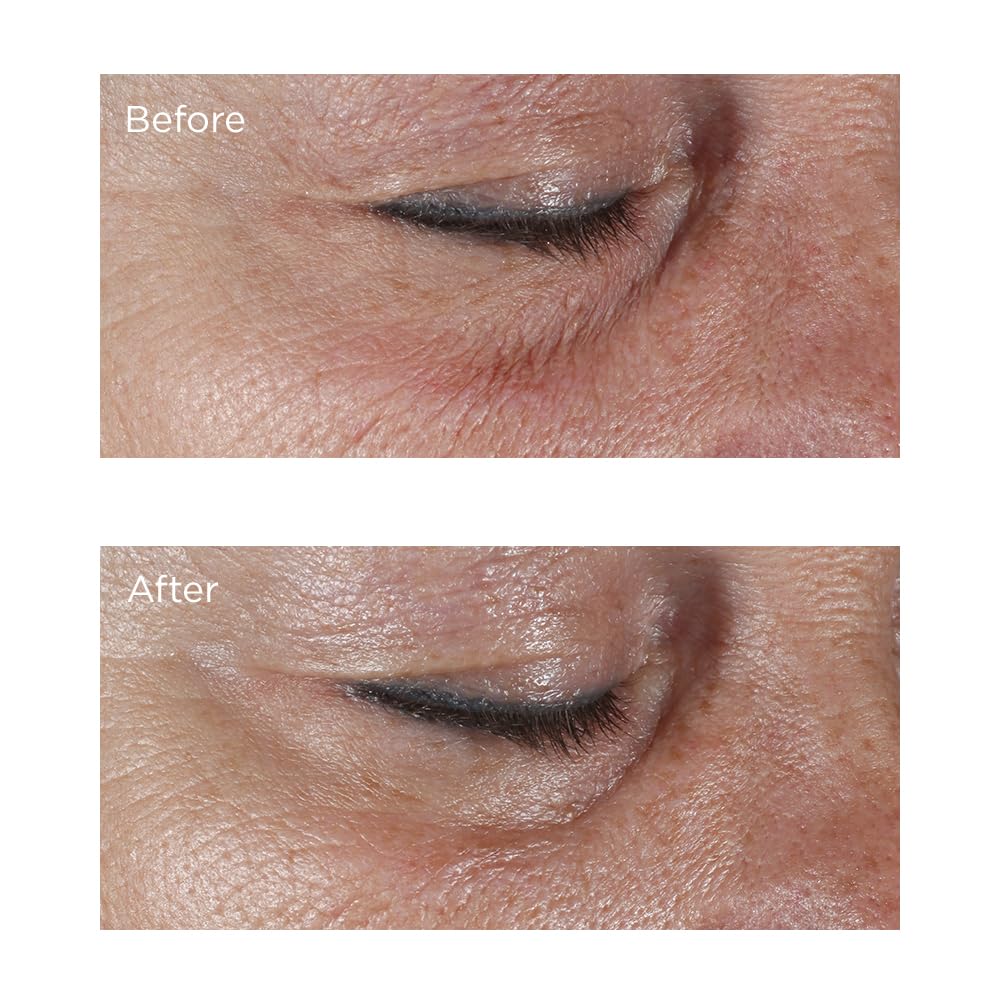 Perricone MD Hypoallergenic Firming Eye Cream, New - 0.5 oz