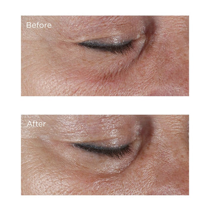 Perricone MD Hypoallergenic Firming Eye Cream, New - 0.5 oz