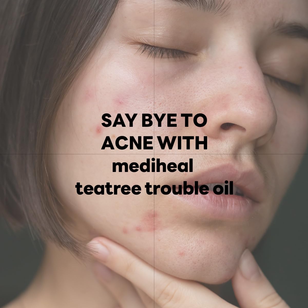Mediheal Teatree Trouble Calming Oil (0.33 fl oz), Quick Calming and Deep Hydration with Control Excess Oil for Sensitive Skin Type