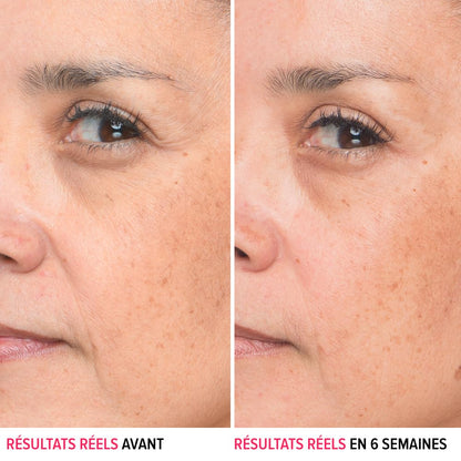 IT Cosmetics Bye Bye Lines Hyaluronic Acid Serum for Face - Hydrating Anti-Aging Facial Serum With Peptide & Vitamin B5, Visibly Plumps Skin, Smooths Look of Fine Lines, For All Skin Types - 1 fl oz