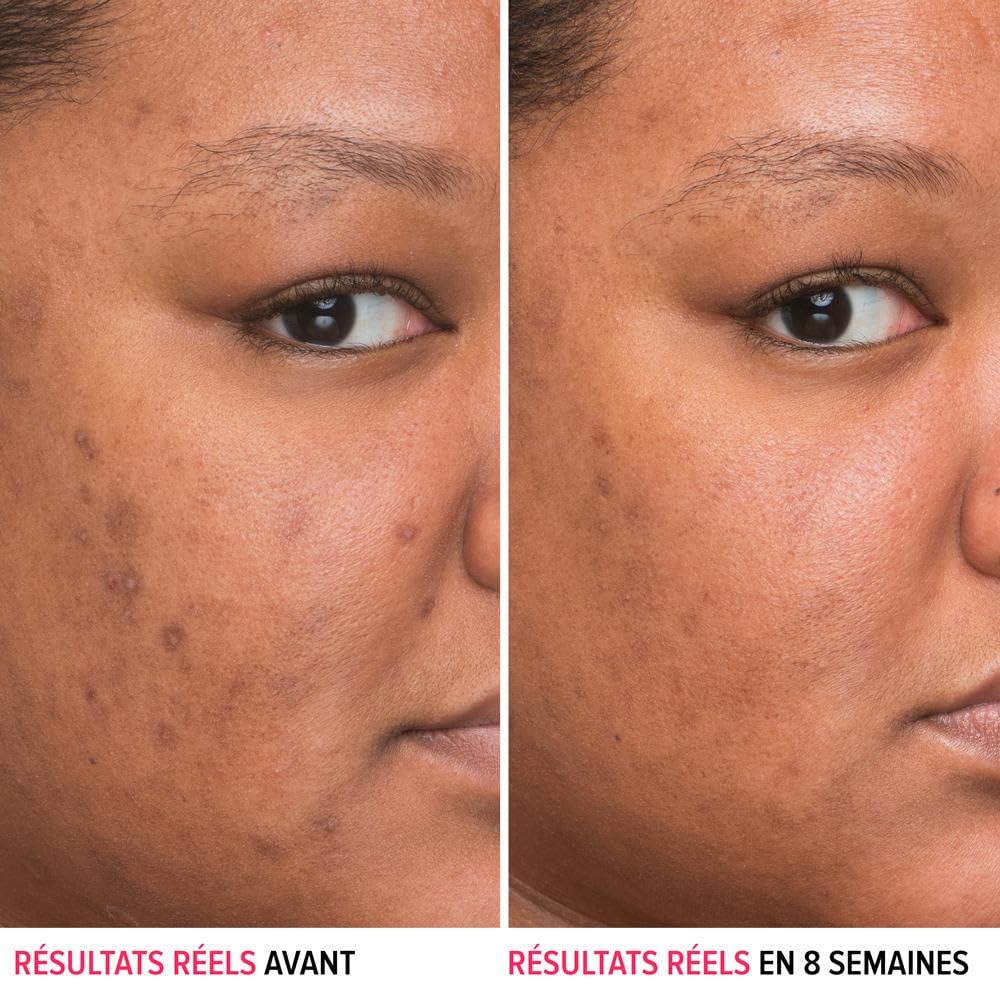 IT Cosmetics Bye Bye Dark Spots 4% Niacinamide Serum - Visibly Reduces Dark Spots & Improves Skin Clarity In 8 Weeks - Facial Serum with 1% Ethyl Vitamin C - For All Skin Types - 1 Fl. Oz