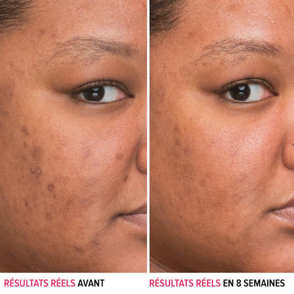 IT Cosmetics Bye Bye Dark Spots 4% Niacinamide Serum - Visibly Reduces Dark Spots & Improves Skin Clarity In 8 Weeks - Facial Serum with 1% Ethyl Vitamin C - For All Skin Types - 1 Fl. Oz