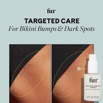 Fur Ingrown Eliminator Serum: Post Hair Removal Care and Ingrown Hair Treatment - 1.1 FL OZ