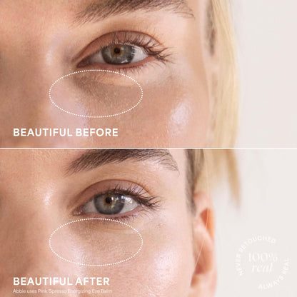 TULA Skin Care Eye Balm Extravaganza - Dark Circle Under Eye Treatment, Instantly Hydrate and Brighten Undereye Area & Leave the Ultimate Glow, 3-Piece Kit