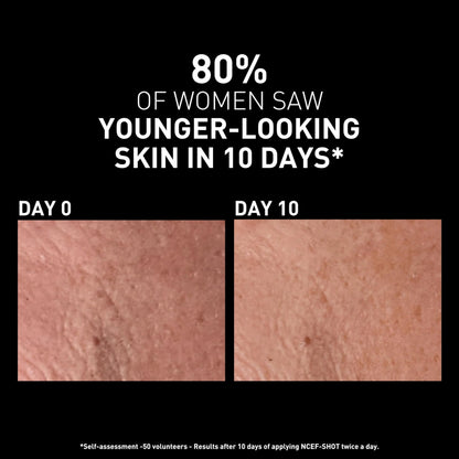 Filorga NCEF-Shot Anti-Aging Serum, Concentrated Wrinkle Reducing Treatment for Radiant & Firm Skin in 10 Days