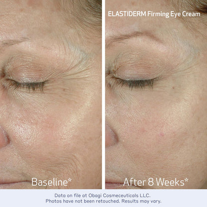 Obagi ELASTIDERM Lift Up & Sculpt Facial Moisturizer and Eye Cream Set – Clinically Proven Anti-Aging Face Cream 1.7oz & Lightweight Eye Cream .5oz Help Reduce the Appearance of Fine Lines & Wrinkles