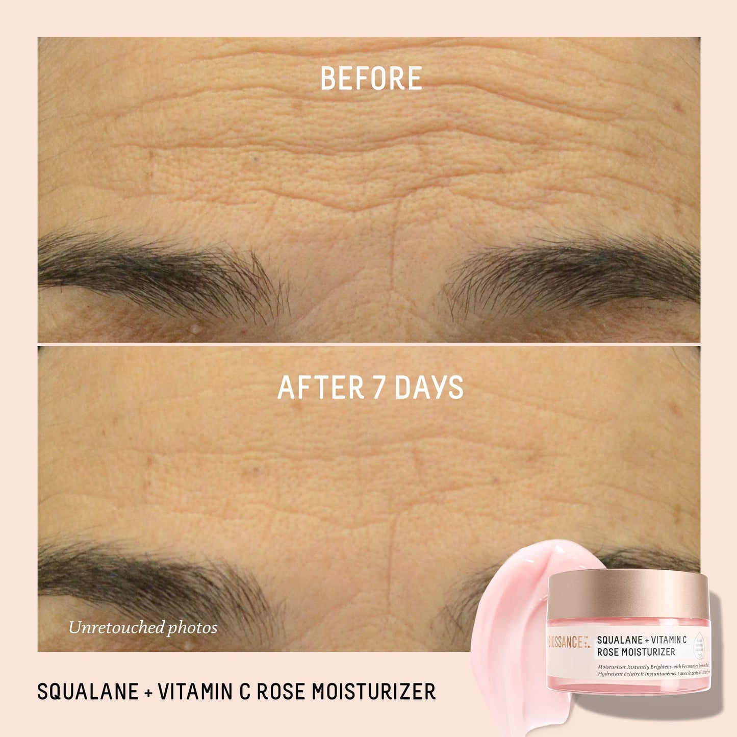 Biossance Squalane + Vitamin C Rose Face Moisturizer – Antioxidant-Rich Day/Night Face Lotion – Hydrates and Smooths Fine Lines – Even Skin Tone & Reduce Discoloration – For Radiant Skin, 1.69 Fl Oz