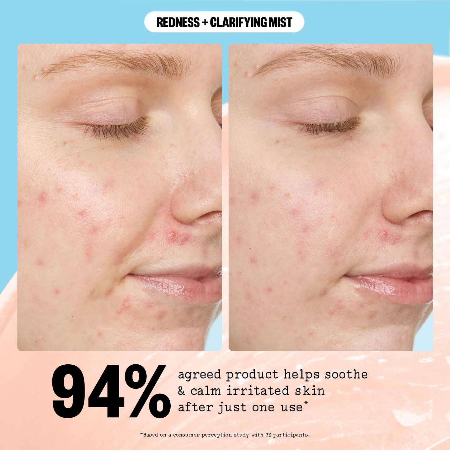 PEACE OUT Redness + Clarifying Mist, Hypochlorous Acid Facial Spray for Acne-Prone Skin, Helps Calm Redness, Control Excess Oil, and Refresh Skin Over and Under Makeup, 3.3 fl oz