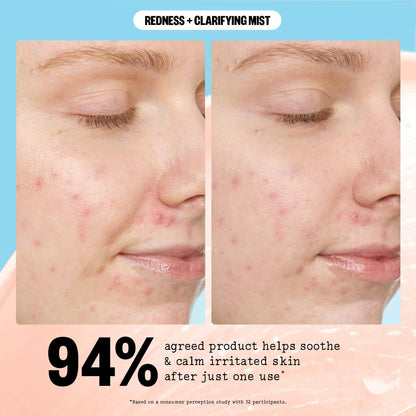 PEACE OUT Redness + Clarifying Mist, Hypochlorous Acid Facial Spray for Acne-Prone Skin, Helps Calm Redness, Control Excess Oil, and Refresh Skin Over and Under Makeup, 3.3 fl oz