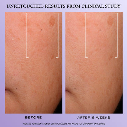 Lancôme Rénergie H.C.F. Triple Serum - Hyaluronic Acid Serum for Visible Correction of Anti Aging Signs & Dark Spots - With Vitamin C+, Niacinamide & Ferulic Acid