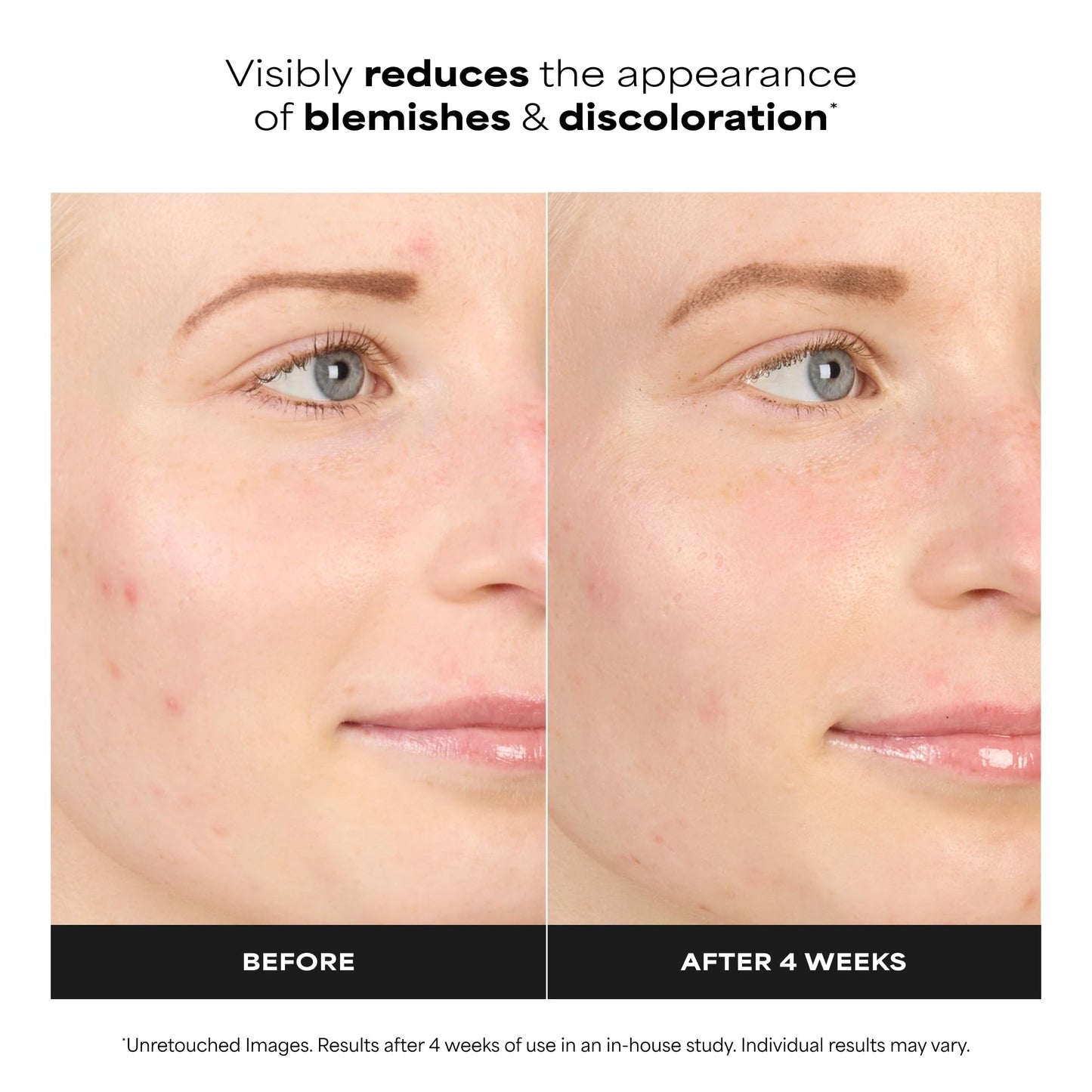 Paula's Choice BOOST 10% Azelaic Acid Booster Cream Gel Face Serum with Salicylic Acid, Oil-Free Skin Brightening Serum for Face, Fragrance-Free