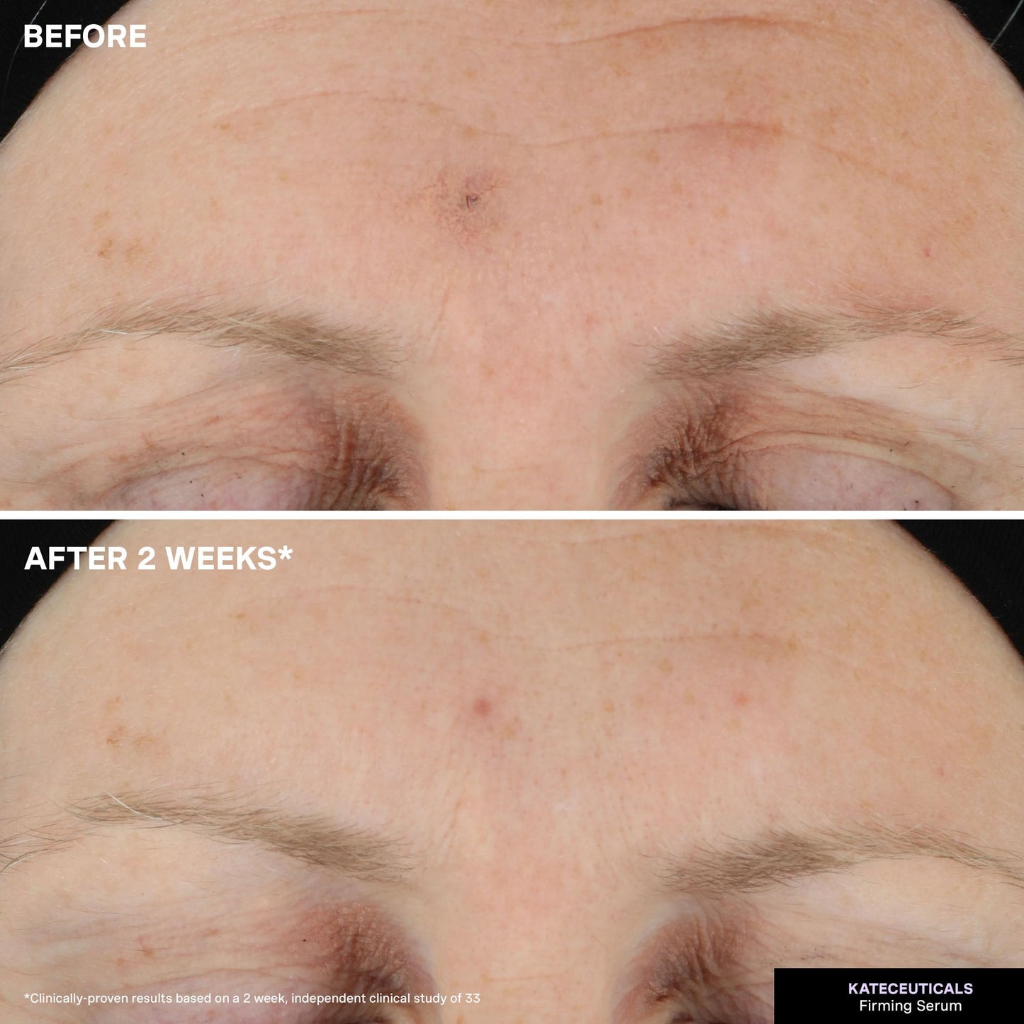 Kate Somerville KateCeuticals Firming Serum | Advanced Anti-Aging Plumping & Firming Treatment