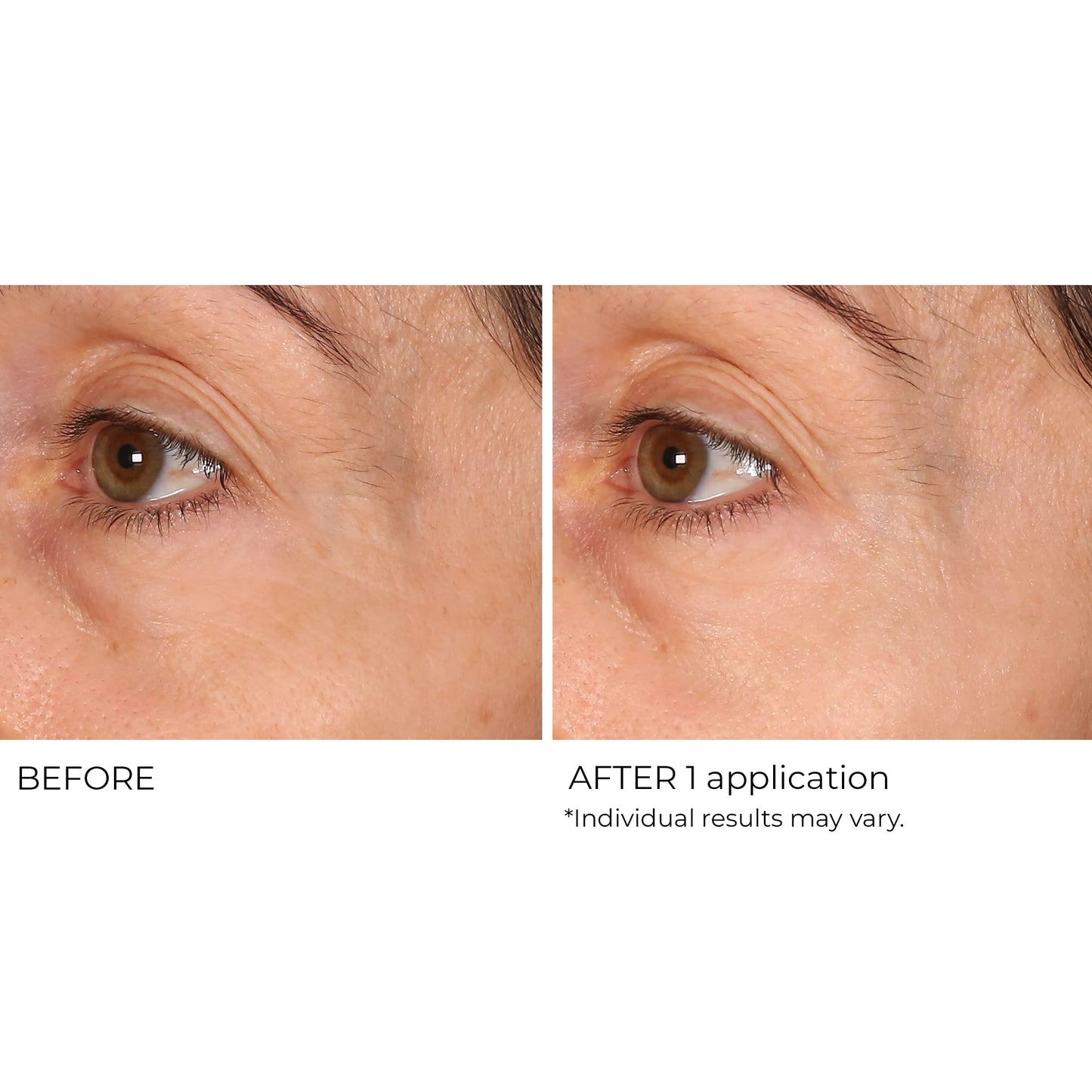 NassifMD Wrinkle Blur Targeted Treatment