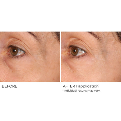 NassifMD Wrinkle Blur Targeted Treatment