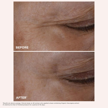 Clarins NEW Total Eye Lift | Anti Aging Eye Cream | Targets Wrinkles, Crow's Feet, Dark Circles and Puffiness For a Visible Eye Lift in 30 Seconds | REFILLABLE