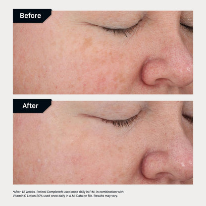 Revision Skincare Retinol Complete® 0.5 Anti Aging Serum, Reduces Fine Lines and Wrinkles, Hydrating and Smoothing