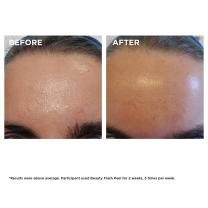 Clarins Beauty Flash Peel | 10-Minute At-Home Facial | Visibly Tightens Pores | Gently Eliminates Dead Skin Cells | Refines Skin Texture | Renews Radiance | Contains AHAs and BHAs | All Skin Types